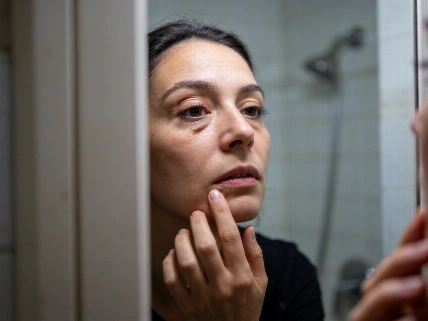 Could Low Iron Explain Dark Circles? Evidence Falls Short Shake Nutrition
